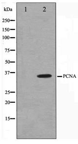 PCNA Antibody - Western blot of HepG2 cell lysate using PCNA Antibody