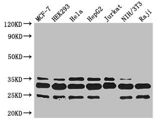 PCNA Antibody - Western Blot Positive WB detected in:MCF-7 whole cell lysate,HEK293 whole cell lysate,Hela whole cell lysate,HepG2 whole cell lysate,Jurkat whole cell lysate,NIH/3T3 whole cell lysate,Raji whole cell lysate All Lanes: PCNA antibody at 3.2ug/ml Secondary Goat polyclonal to rabbit IgG at 1/50000 dilution Predicted band size: 29 kDa Observed band size: 29,25,35 kDa