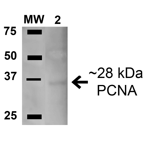 PCNA Antibody - Western blot analysis of Human Embryonic kidney epithelial cell line (HEK293T) lysate showing detection of ~28.7 kDa PCNA protein using Rabbit Anti-PCNA Polyclonal Antibody. Lane 1: Molecular Weight Ladder (MW). Lane 2: Human 293Trap cell lysates. Load: 15 µg. Block: 5% Skim Milk in 1X TBST. Primary Antibody: Rabbit Anti-PCNA Polyclonal Antibody  at 1:1000 for 1 hour. Secondary Antibody: Goat Anti-Rabbit HRP at 1:2000 for 1 hour RT with shaking. Color Development: ECL solution for 6 min in RT. Predicted/Observed Size: ~28.7 kDa.