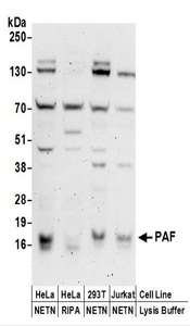 PCNA-Associated Factor Antibody - Detection of Human PAF by Western Blot. Samples: Whole cell lysate (50 ug) prepared using NETN or RIPA buffer from HeLa, 293T, and Jurkat cells. Antibodies: Affinity purified rabbit anti-PAF antibody used for WB at 0.1 ug/ml. Detection: Chemiluminescence with an exposure time of 3 minutes.