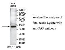 PCNA-Associated Factor Antibody