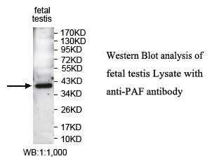 PCNA-Associated Factor Antibody