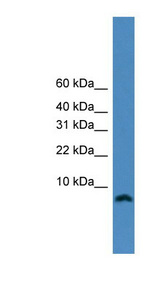 PCNA-Associated Factor Antibody - KIAA0101 antibody Western blot of HepG2 cell lysate. This image was taken for the unconjugated form of this product. Other forms have not been tested.