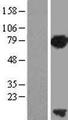 PCNA-Associated Factor Protein - Western validation with an anti-DDK antibody * L: Control HEK293 lysate R: Over-expression lysate