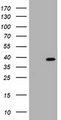PCNA Protein - Western validation with an anti-DDK antibody * L: Control HEK293 lysate R: Over-expression lysate