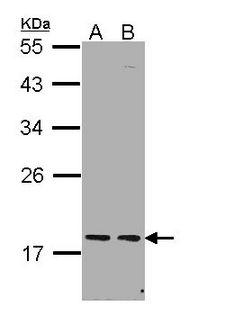 PCNP Antibody - Sample (30 ug of whole cell lysate). A: H1299, B: Hela. 12% SDS PAGE. PCNP antibody diluted at 1:1000.