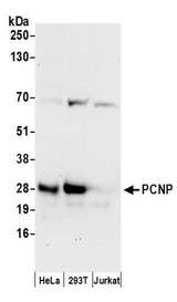PCNP Antibody - Detection of human PCNP by western blot. Samples: Whole cell lysate (50 µg) from HeLa, HEK293T, and Jurkat cells prepared using NETN lysis buffer. Antibodies: Affinity purified rabbit anti-PCNP antibody used for WB at 0.04 µg/ml. Detection: Chemiluminescence with an exposure time of 30 seconds.