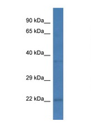 PCNP Antibody - PCNP antibody Western blot of Mouse Spleen lysate. Antibody concentration 1 ug/ml. This image was taken for the unconjugated form of this product. Other forms have not been tested.