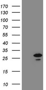 PCNP Antibody - HEK293T cells were transfected with the pCMV6-ENTRY control. (Left lane) or pCMV6-ENTRY PCNP. (Right lane) cDNA for 48 hrs and lysed. Equivalent amounts of cell lysates. (5 ug per lane) were separated by SDS-PAGE and immunoblotted with anti-PCNP. (1:2000)