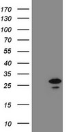 PCNP Antibody - HEK293T cells were transfected with the pCMV6-ENTRY control. (Left lane) or pCMV6-ENTRY PCNP. (Right lane) cDNA for 48 hrs and lysed
