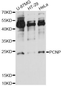 PCNP Antibody - Western blot analysis of extracts of various cell lines, using PCNP antibody at 1:1000 dilution. The secondary antibody used was an HRP Goat Anti-Rabbit IgG (H+L) at 1:10000 dilution. Lysates were loaded 25ug per lane and 3% nonfat dry milk in TBST was used for blocking. An ECL Kit was used for detection and the exposure time was 90s.