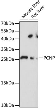 PCNP Antibody - Western blot analysis of extracts of various cell lines, using PCNP antibody at 1:1000 dilution. The secondary antibody used was an HRP Goat Anti-Rabbit IgG (H+L) at 1:10000 dilution. Lysates were loaded 25ug per lane and 3% nonfat dry milk in TBST was used for blocking. An ECL Kit was used for detection and the exposure time was 30s.