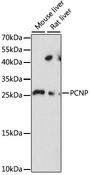 PCNP Antibody - Western blot analysis of extracts of various cell lines, using PCNP antibody at 1:1000 dilution. The secondary antibody used was an HRP Goat Anti-Rabbit IgG (H+L) at 1:10000 dilution. Lysates were loaded 25ug per lane and 3% nonfat dry milk in TBST was used for blocking. An ECL Kit was used for detection and the exposure time was 30s.