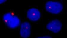 PCNT / Pericentrin Antibody - Detection of Human Pericentrin/Kendrin by Immunocytochemistry. Sample: NBF-fixed asynchronous HeLa cells. Antibody: Affinity purified rabbit anti-Pericentrin/Kendrin used at a dilution of 1:100. Detection: Red-fluorescent Alexa Fluor 594 goat anti-rabbit IgG (Invitrogen).