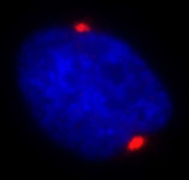 PCNT / Pericentrin Antibody - Detection of Human Pericentrin/Kendrin by Immunocytochemistry. Sample: NBF-fixed asynchronous HeLa cells. Antibody: Affinity purified rabbit anti-Pericentrin/Kendrin used at a dilution of 1:500. Detection: Red-fluorescent Alexa Fluor 594 goat anti-rabbit IgG (Invitrogen).