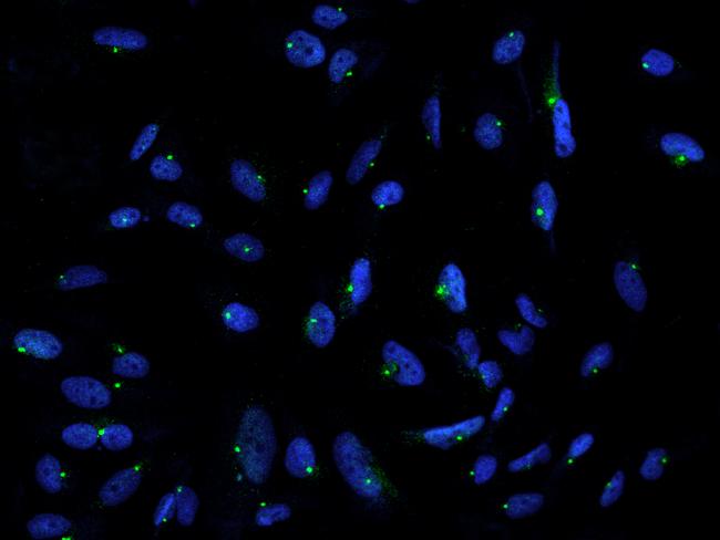 PCNT / Pericentrin Antibody - Immunofluorescence staining of PCNT in U251MG cells. Cells were fixed with 4% PFA, permeabilzed with 0.1% Triton X-100 in PBS, blocked with 10% serum, and incubated with rabbit anti-Human PCNT polyclonal antibody (dilution ratio 1:200) at 4°C overnight. Then cells were stained with the Alexa Fluor 488-conjugated Goat Anti-rabbit IgG secondary antibody (green) and counterstained with DAPI (blue). Positive staining was localized to Centrosome.