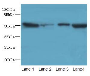 PCOLCE2 Antibody - Western blot. All lanes: PCOLCE2 antibody at 8 ug/ml. Lane 1: MCF7 whole cell lysate. Lane 2: A549 whole cell lysate. Lane 3: HCT116 whole cell lysate. Lane 4: Human high value serum. Secondary antibody: Goat polyclonal to Rabbit IgG at 1:10000 dilution. Predicted band size: 46 kDa. Observed band size: 46 kDa.