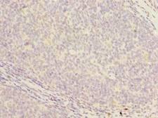 PCOLCE2 Antibody - Immunohistochemistry of paraffin-embedded human tonsil tissue using antibody at dilution of 1:100.