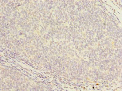 PCOLCE2 Antibody - Immunohistochemistry of paraffin-embedded human tonsil tissue using PCOLCE2 Antibody at dilution of 1:100
