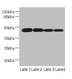 PCOLCE2 Antibody - Western blot All lanes: PCOLCE2 antibody at 8µg/ml Lane 1: MCF-7 whole cell lysate Lane 2: A549 whole cell lysate Lane 3: HCT116 whole cell lysate Lane 4: Human high value serumSecondary Goat polyclonal to rabbit IgG at 1/10000 dilution Predicted band size: 46 kDa Observed band size: 46 kDa