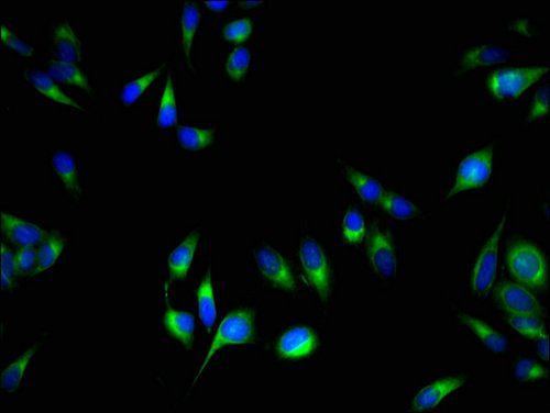 PCOTH Antibody - Immunofluorescent analysis of Hela cells using C1QTNF9B-AS1 Antibody at a dilution of 1:100 and Alexa Fluor 488-congugated AffiniPure Goat Anti-Rabbit IgG(H+L)