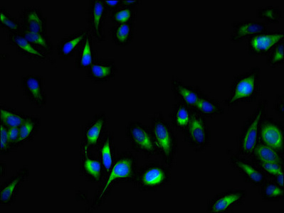 PCOTH Antibody - Immunofluorescent analysis of Hela cells using C1QTNF9B-AS1 Antibody at dilution of 1:100 and Alexa Fluor 488-congugated AffiniPure Goat Anti-Rabbit IgG(H+L)