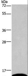 PCP4 / PEP19 Antibody - Western blot analysis of Mouse brain tissue, using PCP4 Polyclonal Antibody at dilution of 1:1000.
