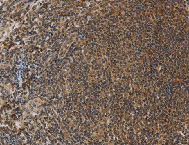 PCP4 / PEP19 Antibody - Immunohistochemistry of paraffin-embedded Human tonsil using PCP4 Polyclonal Antibody at dilution of 1:50.