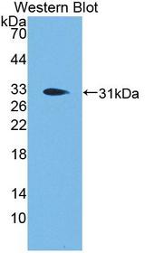 PCSK1 Antibody - Western blot of PCSK1 antibody.