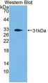 PCSK1 Antibody - Western blot of PCSK1 antibody.