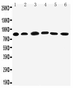PCSK1 Antibody - WB of PCSK1 / PC1 antibody. Lane 1: Rat Liver Tissue Lysate. Lane 2: Rat Thymus Tissue Lysate. Lane 3: A549 Cell Lysate. Lane 4: HELA Cell Lysate. Lane 5: COLO320 Cell Lysate. Lane 6: PANC Cell Lysate.