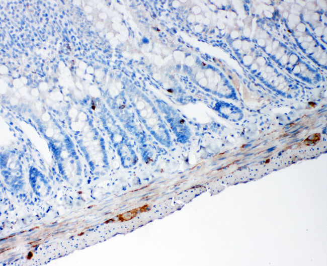 PCSK1 Antibody - PCSK1 / PC1 antibody. IHC(P): Rat Intestine Tissue.