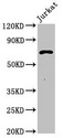 PCSK1 Antibody - Positive Western Blot detected in Jurkat whole cell lysate. All lanes: Pcsk1 antibody at 3 µg/ml Secondary Goat polyclonal to rabbit IgG at 1/50000 dilution. Predicted band size: 71 KDa. Observed band size: 71 KDa