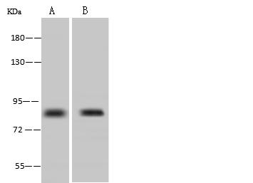 PCSK1 Antibody - Anti-PCSK1 rabbit polyclonal antibody at 1:500 dilution. Lane A: HCT116 Whole Cell Lysate. Lane B: Hela Whole Cell Lysate. Lysates/proteins at 30 ug per lane. Secondary: Goat Anti-Rabbit IgG (H+L)/HRP at 1/10000 dilution. Developed using the ECL technique. Performed under reducing conditions. Predicted band size: 84 kDa. Observed band size: 84 kDa.