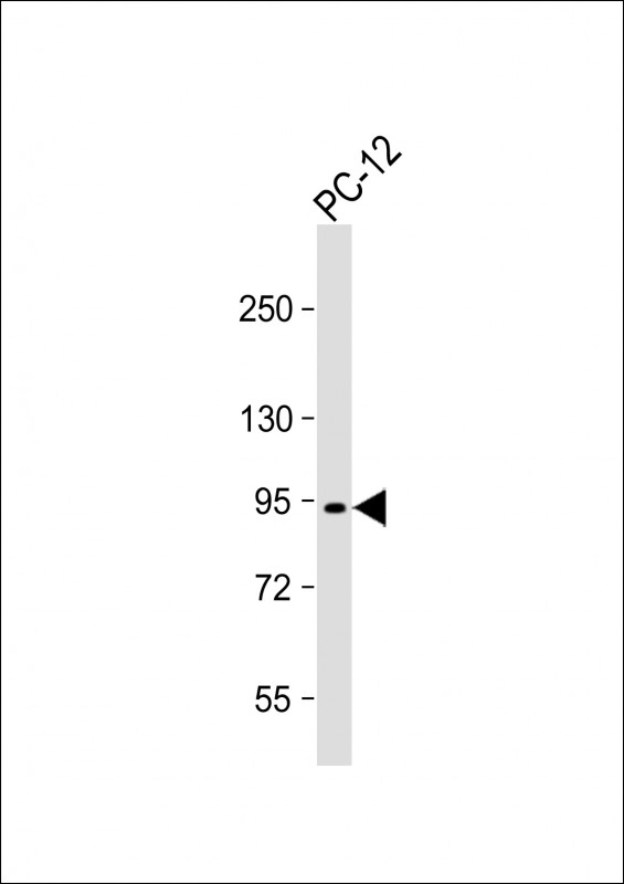 PCSK1 Antibody - Anti-PCSK1 Antibody (N-Term) at 1:1000 dilution + PC-12 whole cell lysate Lysates/proteins at 20 µg per lane. Secondary Goat Anti-Rabbit IgG, (H+L), Peroxidase conjugated at 1/10000 dilution. Predicted band size: 84 kDa Blocking/Dilution buffer: 5% NFDM/TBST.