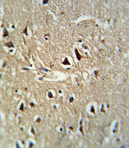 PCSK2 Antibody - Formalin-fixed and paraffin-embedded human brain tissue reacted with PCSK2 Antibody , which was peroxidase-conjugated to the secondary antibody, followed by DAB staining. This data demonstrates the use of this antibody for immunohistochemistry; clinical relevance has not been evaluated.