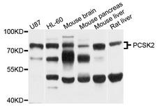 PCSK2 Antibody - Western blot analysis of extract of various cells.