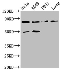 PCSK2 Antibody - Positive Western Blot detected in Hela whole cell lysate, A549 whole cell lysate, U251 whole cell lysate, Mouse lung tissue. All lanes: Pcsk1 antibody at 8 µg/ml Secondary Goat polyclonal to rabbit IgG at 1/50000 dilution. Predicted band size: 85 KDa. Observed band size: 85 KDa