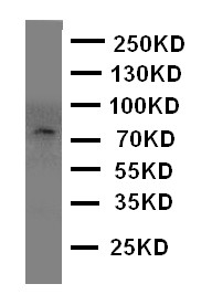 PCSK4 Antibody - WB of PCSK4 / PC4 antibody. WB: Rat Brain Tissue.