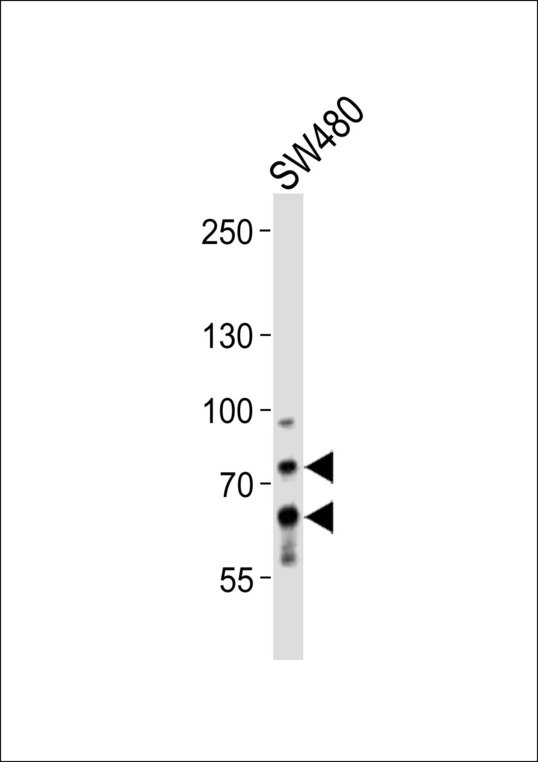 PCSK9 Antibody - Western blot of lysate from SW480 cell line, using PCSK9 Antibody. Antibody was diluted at 1:1000. A goat anti-rabbit IgG H&L (HRP) at 1:10000 dilution was used as the secondary antibody. Lysate at 20ug.