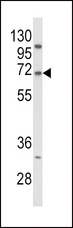 PCSK9 Antibody - Western blot of PCSK9 Antibody in Jurkat cell line lysates (35 ug/lane). PCSK9 (arrow) was detected using the purified antibody.