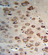 PCSK9 Antibody - PCSK9 Antibody (RB19130) IHC of formalin-fixed and paraffin-embedded human brain tissue followed by peroxidase-conjugated secondary antibody and DAB staining.