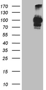PCSK9 Antibody - HEK293T cells were transfected with the pCMV6-ENTRY control. (Left lane) or pCMV6-ENTRY PCSK9. (Right lane) cDNA for 48 hrs and lysed. Equivalent amounts of cell lysates. (5 ug per lane) were separated by SDS-PAGE and immunoblotted with anti-PCSK9. (1:500)