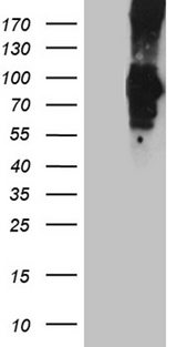 PCSK9 Antibody - HEK293T cells were transfected with the pCMV6-ENTRY control. (Left lane) or pCMV6-ENTRY PCSK9. (Right lane) cDNA for 48 hrs and lysed. Equivalent amounts of cell lysates. (5 ug per lane) were separated by SDS-PAGE and immunoblotted with anti-PCSK9. (1:500)