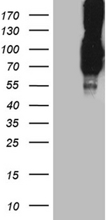 PCSK9 Antibody - HEK293T cells were transfected with the pCMV6-ENTRY control. (Left lane) or pCMV6-ENTRY PCSK9. (Right lane) cDNA for 48 hrs and lysed