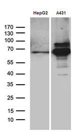 PCSK9 Antibody - Western blot analysis of extracts. (35ug) from 2 different cell lines by using anti-PCSK9 monoclonal antibody. (1:500)