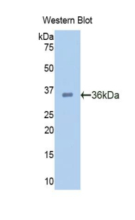 PCSK9 Antibody - Western blot of PCSK9 antibody.