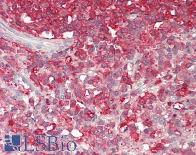 PCSK9 Antibody - Human Spleen: Formalin-Fixed, Paraffin-Embedded (FFPE).  This image was taken for the unconjugated form of this product. Other forms have not been tested.