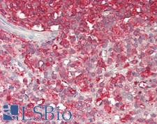 PCSK9 Antibody - Human Spleen: Formalin-Fixed, Paraffin-Embedded (FFPE).  This image was taken for the unconjugated form of this product. Other forms have not been tested.