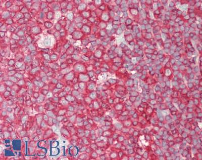 PCSK9 Antibody - Human Tonsil: Formalin-Fixed, Paraffin-Embedded (FFPE).  This image was taken for the unconjugated form of this product. Other forms have not been tested.